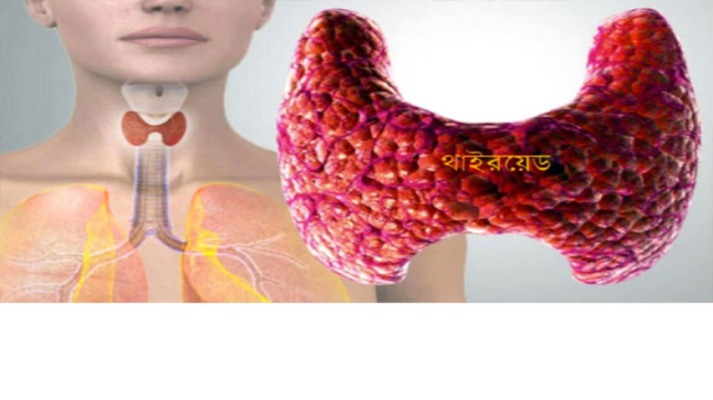 থাইরয়েড রোগ: উপসর্গ, কারণ ও নিয়ন্ত্রণে করণীয়