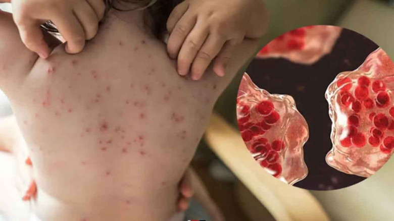 ৪৮ ঘণ্টায় ৪ মৃত্যু, আতঙ্ক বাড়ছে বরিশালে