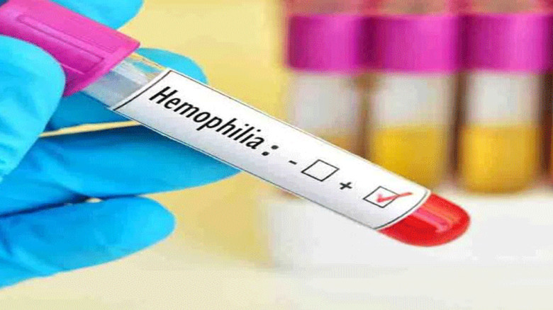 হিমোফিলিয়া: রক্ত জমাট না বাঁধার জটিল রোগ ও এর লক্ষণ...