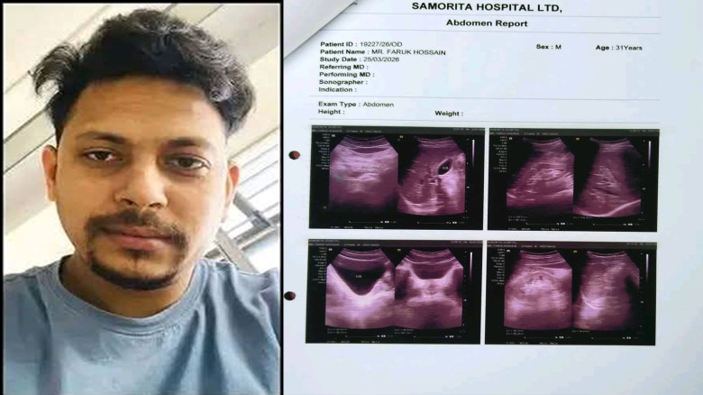 দুই কিডনি বিকল, বাঁচতে সমাজের সহায়তা চান ফারুক হোসেন জাহাঙ্গ