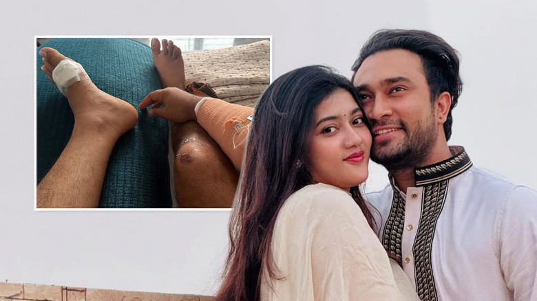 কক্সবাজারে সড়ক দুর্ঘটনায় আহত জোভান ও স্ত্রী, চিকিৎসাধীন দুজন