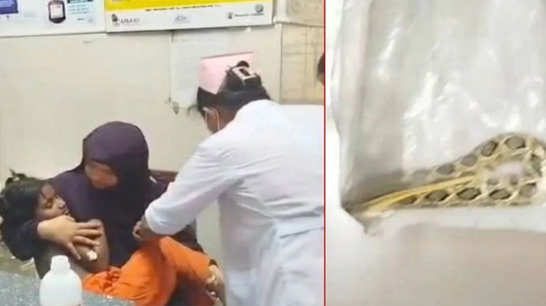“রাসেল ভাইপার” সাপের কামড়ে আহত শিশু