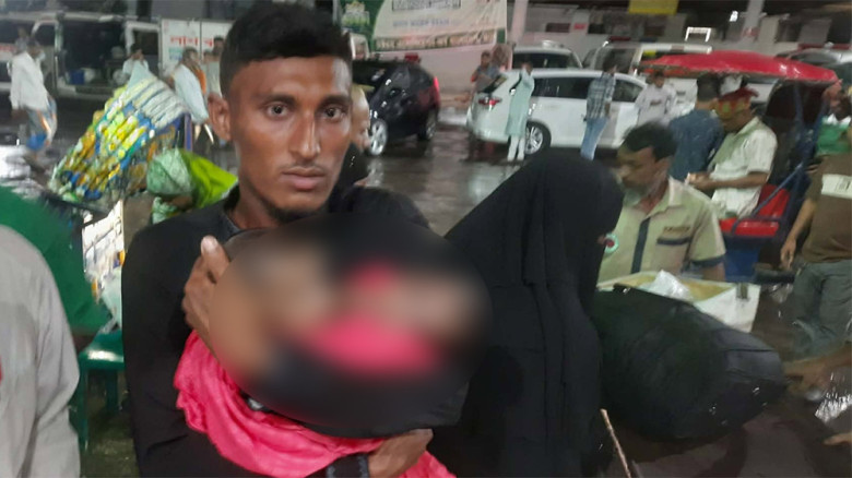 ঢামেকে চিকিৎসাধীন জোড়া লাগা দুই শিশুর মৃত্যু