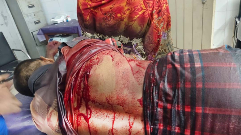 গোমস্তাপুরে ডাকাতের হামলায় ভ্যানচালক গুরুতর আহত